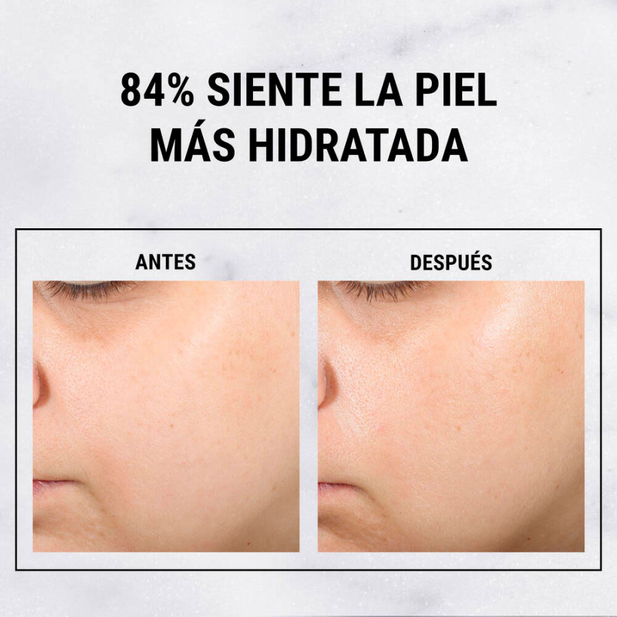 serum-acido-hialuronico-ultra-pure-high-potency serum-acido-hialuronico-ultra-pure-high-potency