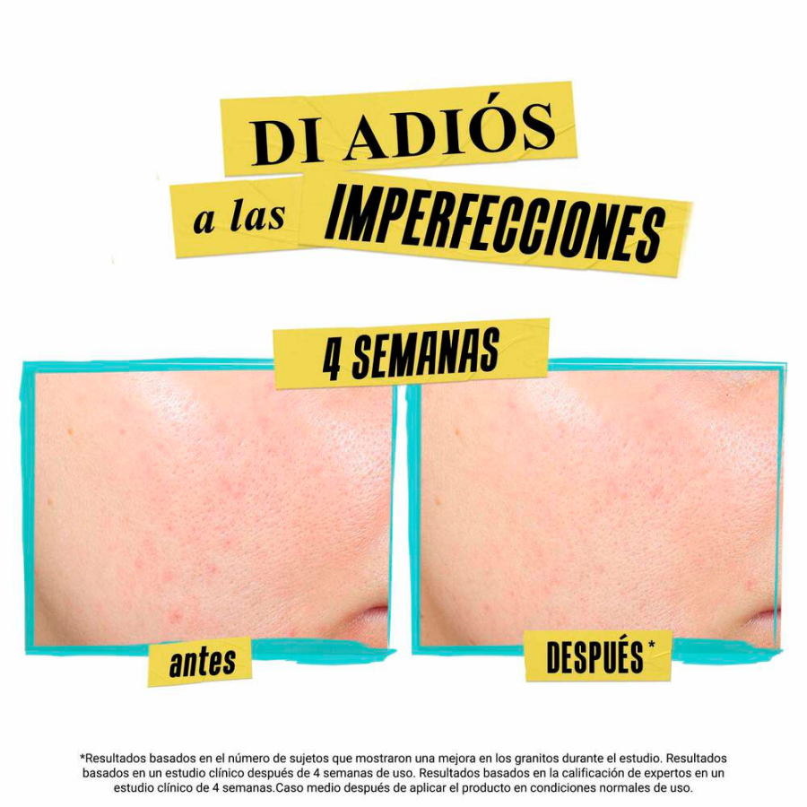 expertly-clear-blemish-treating-preventing-lotion expertly-clear-blemish-treating-preventing-lotion