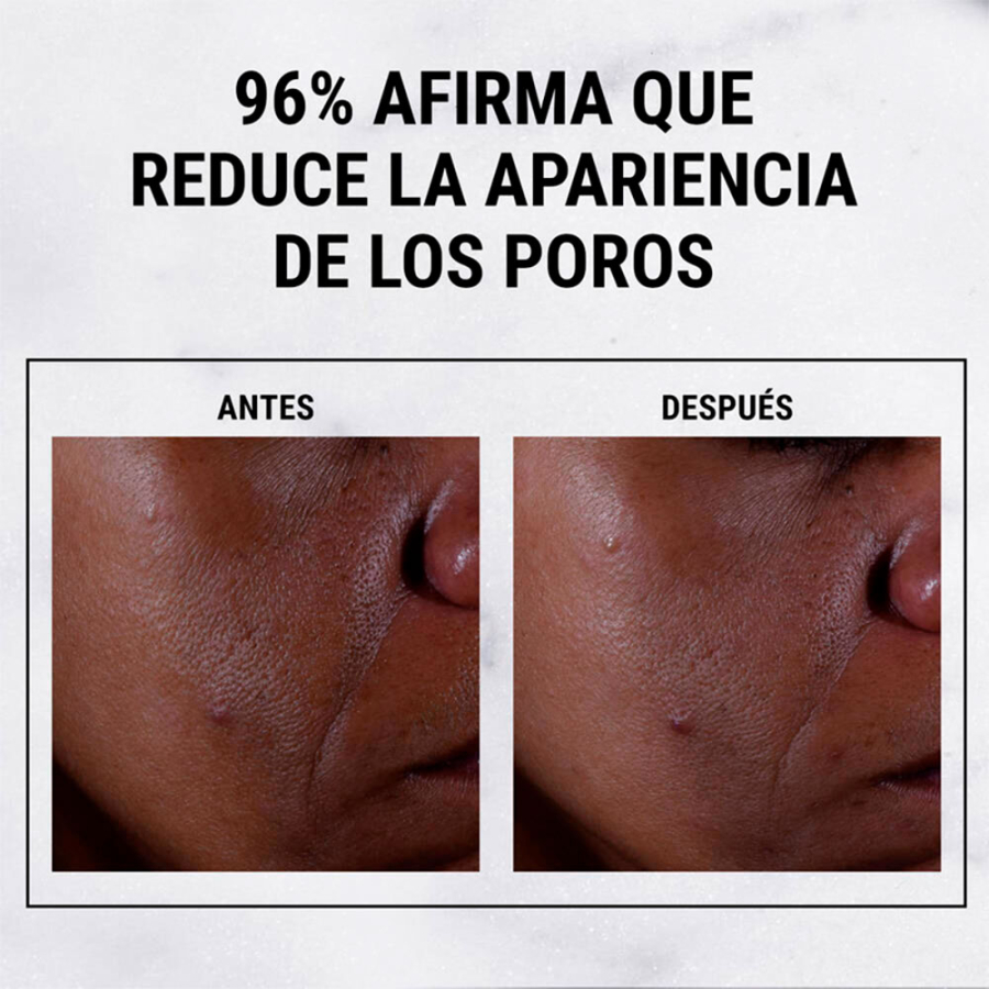 serum-acido-glicolico-ultra-pure-high-potency serum-acido-glicolico-ultra-pure-high-potency