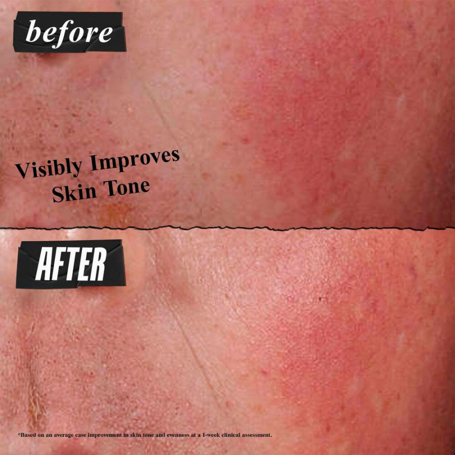 ultra-facial-advanced-repair-barrier-cream ultra-facial-advanced-repair-barrier-cream