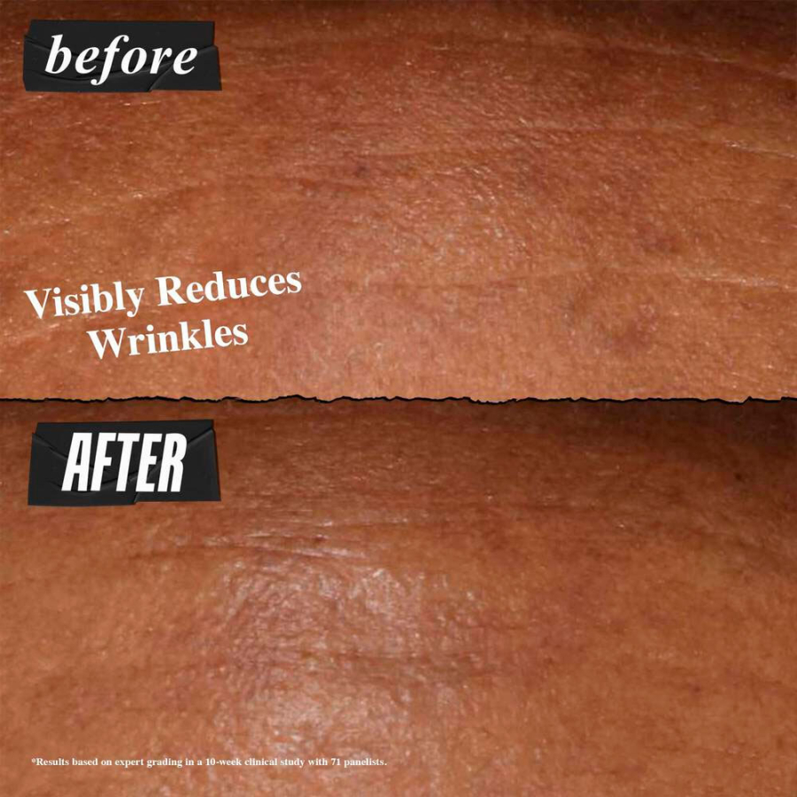 retinol-fast-release-wrinkle-reducing-night-serum retinol-fast-release-wrinkle-reducing-night-serum