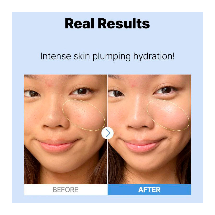 the-hyaluronic-acid-3-serum-crema-facial-hidratante the-hyaluronic-acid-3-serum-crema-facial-hidratante