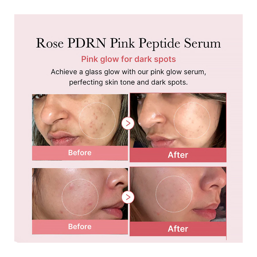 pdrn-pink-peptide-serum-serum-nawilzajace-i-ujedrniajace