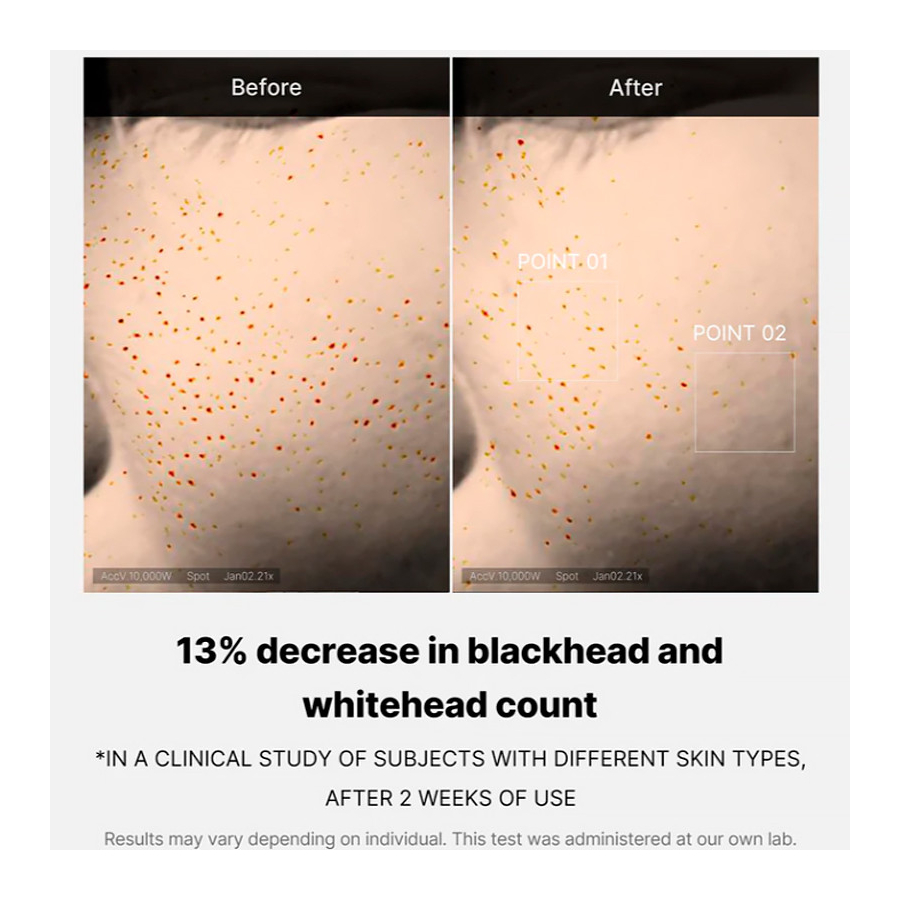 zero-pore-one-day-serum-exfolierend-gezichtsserum-reiniger