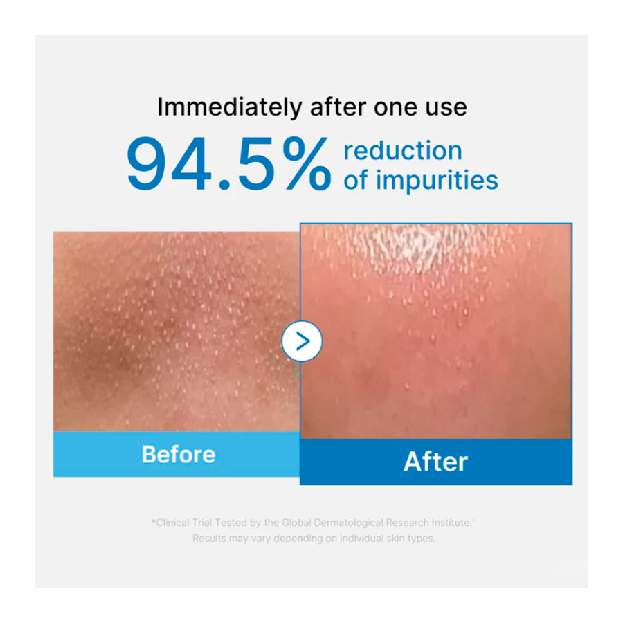 zero-pore-blackhead-deep-cleansing-oil-facial-cleansing-oil