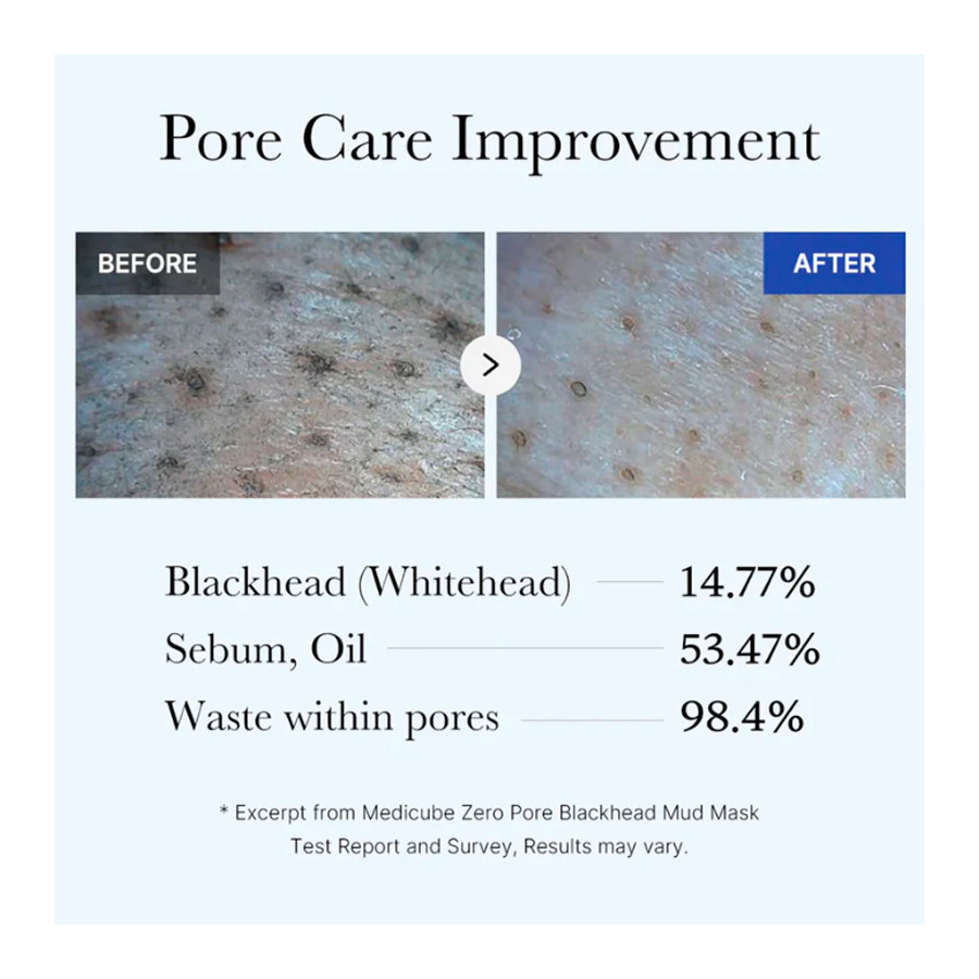 zero-pore-blackhead-mud-mask-cleansing-mask