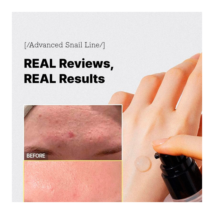 advanced-snail-96-mucin-power-essence-tratamiento-regenerador-antiarrugas