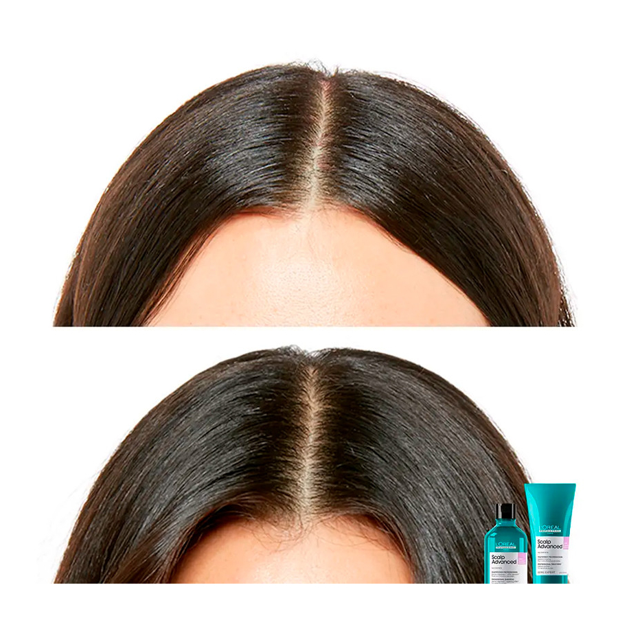 scalp-advanced-anti-discomfort-shampoo scalp-advanced-anti-discomfort-shampoo