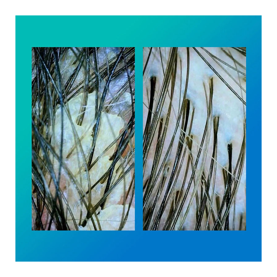 peptide-prep-champu-detox