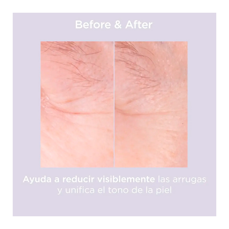 glicoisdin-15-moderate-gel-exfoliante-con-acido-glicolico glicoisdin-15-moderate-gel-exfoliante-con-acido-glicolico