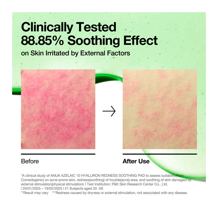 azelaic-10-hyaluron-redness-soothing-pad-discos-de-algodao-faciais-calmantes-vermelhidao azelaic-10-hyaluron-redness-soothing-pad-discos-de-algodao-faciais-calmantes-vermelhidao