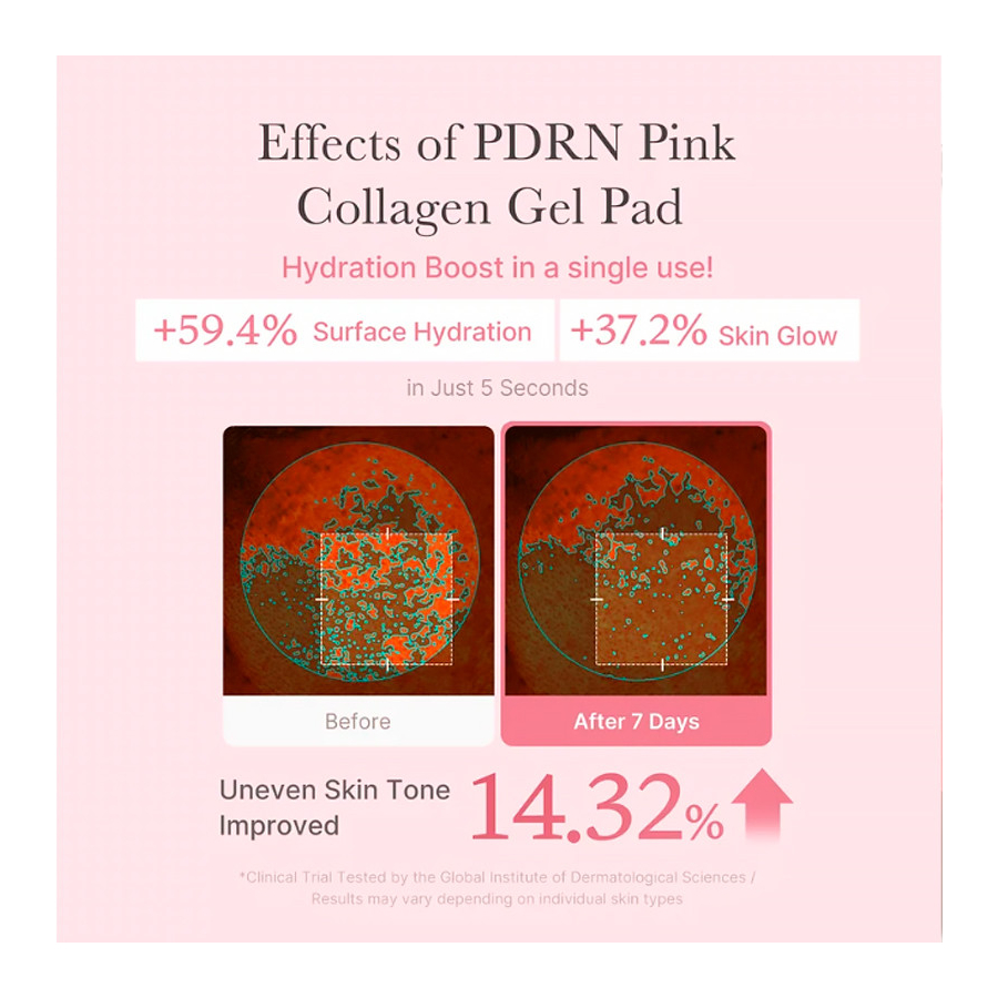 pdrn-pink-collagen-gel-toner-pad-discos-com-efeito-iluminador-de-colageno