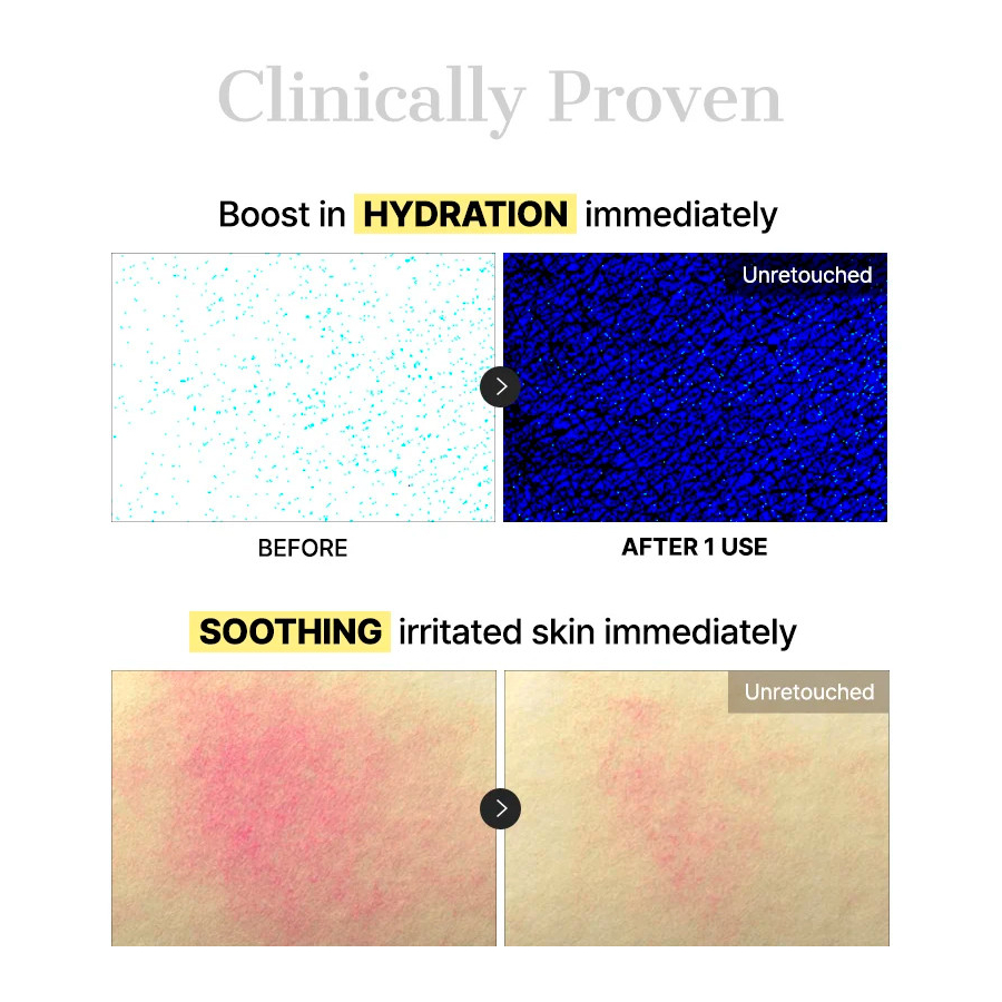 pack-3-advanced-snail-mucin-glass-glow-hydrogel-mask-mascara-facial-multifuncional pack-3-advanced-snail-mucin-glass-glow-hydrogel-mask-mascara-facial-multifuncional