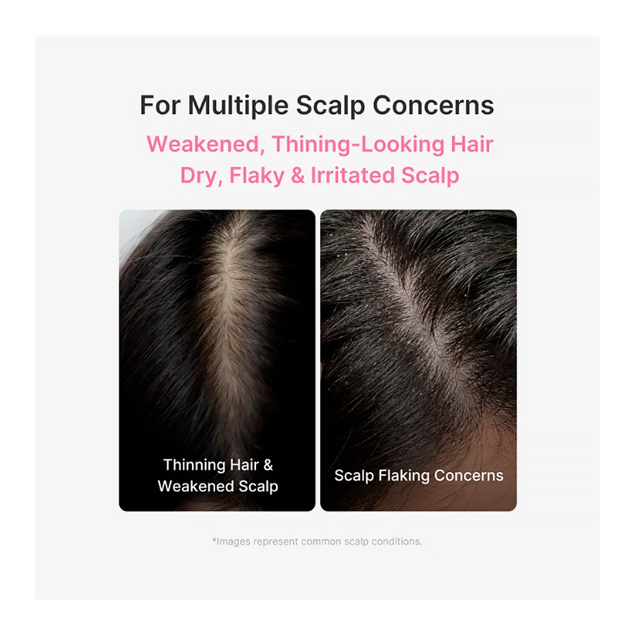 rosemary-pdrn-scalp-serum-serum-capilar-fortalecedor rosemary-pdrn-scalp-serum-serum-capilar-fortalecedor